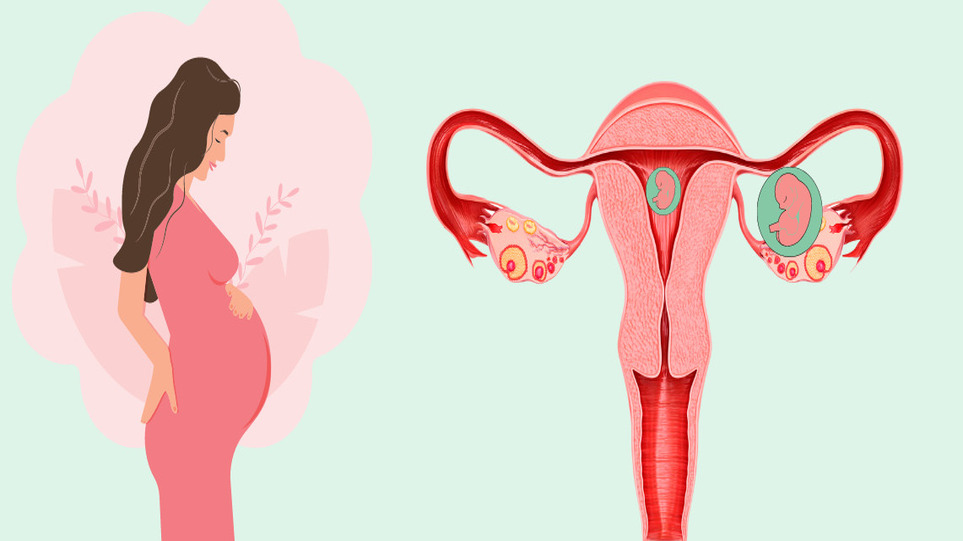 بارداری هتروتوپیک